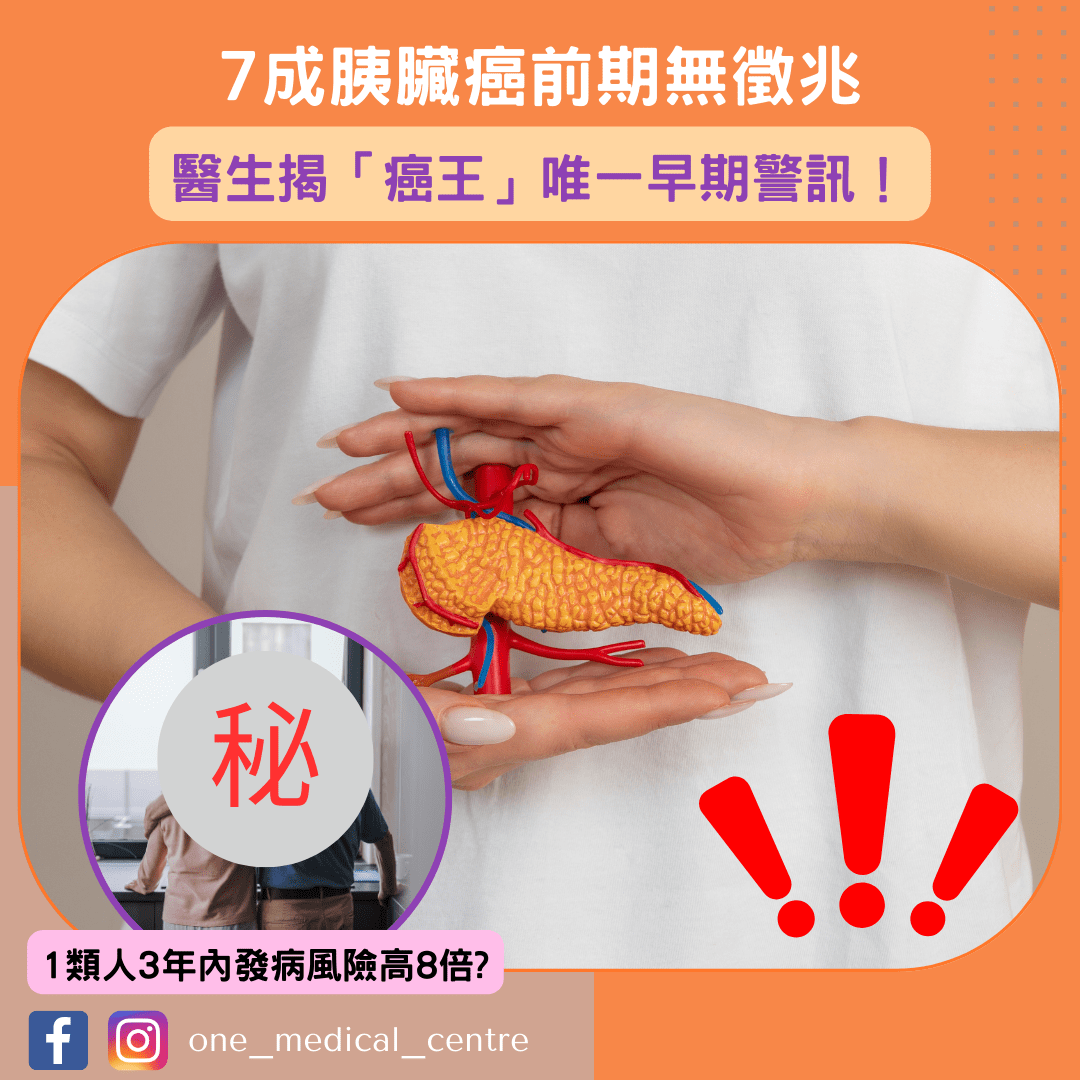 【7成胰臟癌前期無徵兆　醫生揭「癌王」唯一早期警訊：1類人3年內發病風險高8倍】